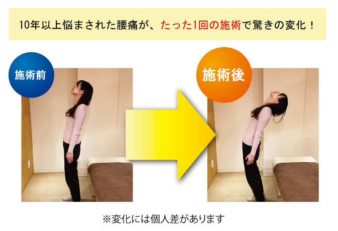 10年以上悩まされた腰痛が、たった1回の施術で驚きの変化