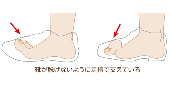 浮指