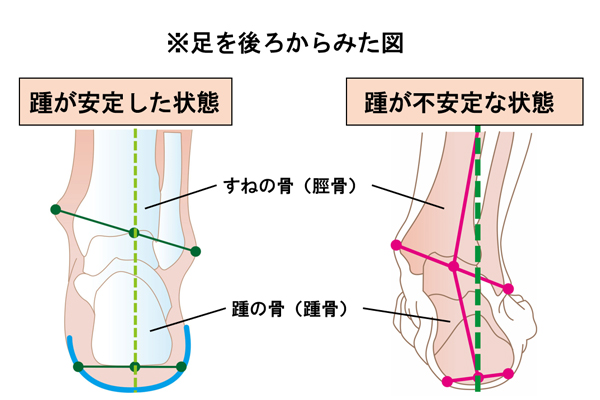 足を後ろから見た図