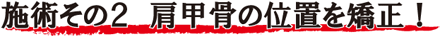 施術その2