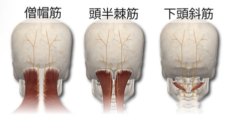 圧迫を引き起こす筋肉