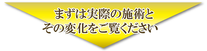 実際の施術とその変化