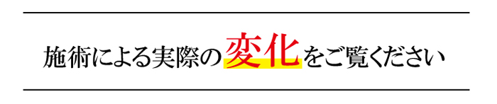 施術による実際の変化