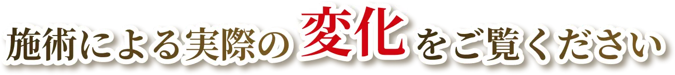 施術による実際の変化をご覧ください
