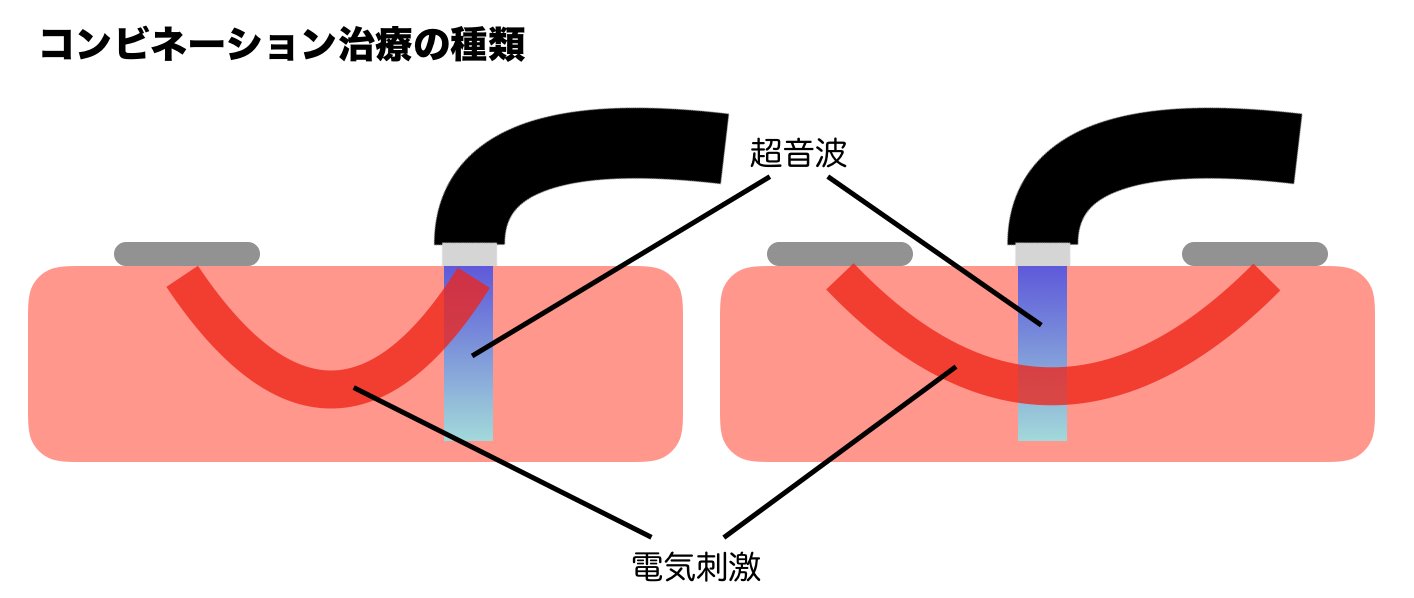 コンビネーション治療の種類