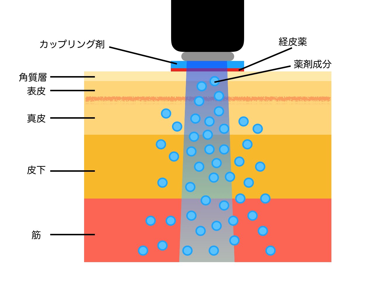 超音波によるキャビテーションと組織内の気泡のイメージ