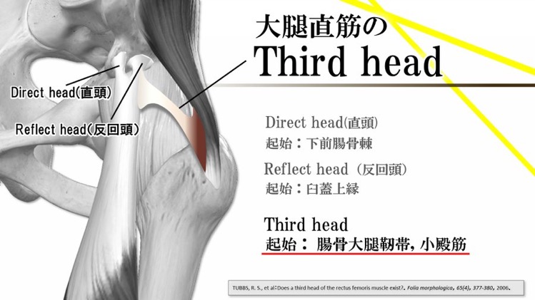 大腿直筋の第三頭