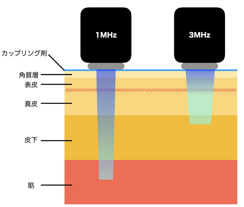 超音波の周波数と深達度の違いを示した解説図