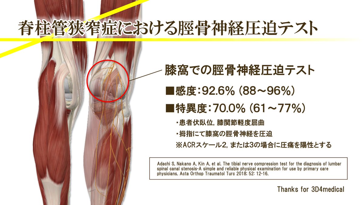 脊柱管狭窄症における脛骨神経圧迫テストの説明画像