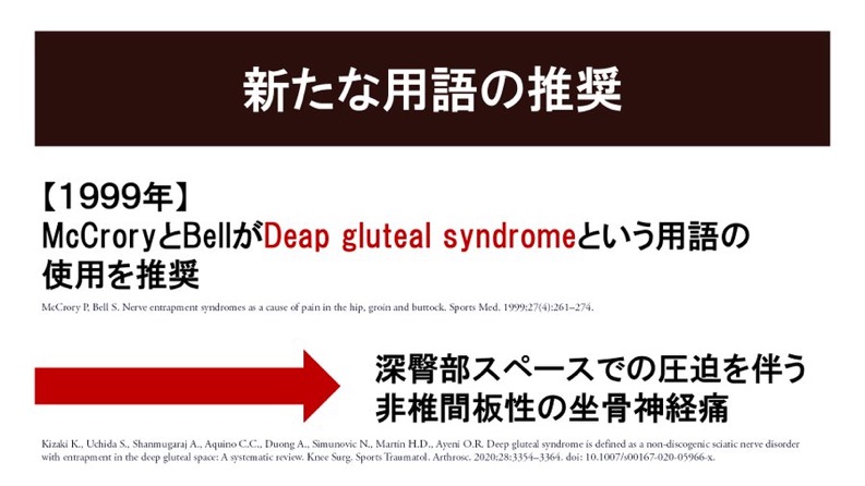 梨状筋症候群ではなくDGS（深殿部症候群：Deep Gluteal Syndrome）という用語が推奨される理由
