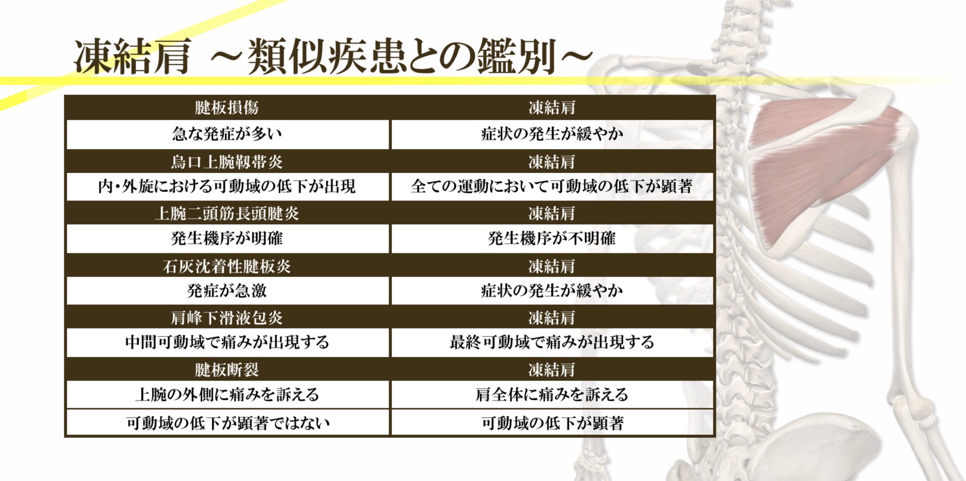 凍結肩の病期と介入の考え方