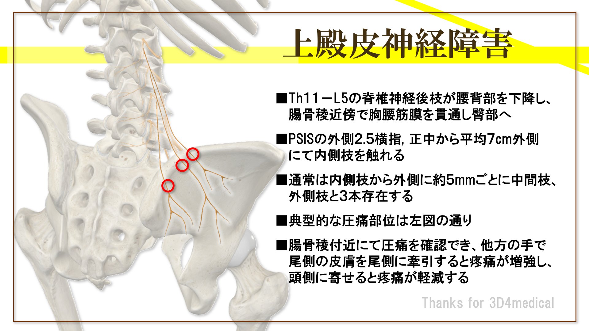 上殿皮神経障害の圧痛点と評価に関するまとめ