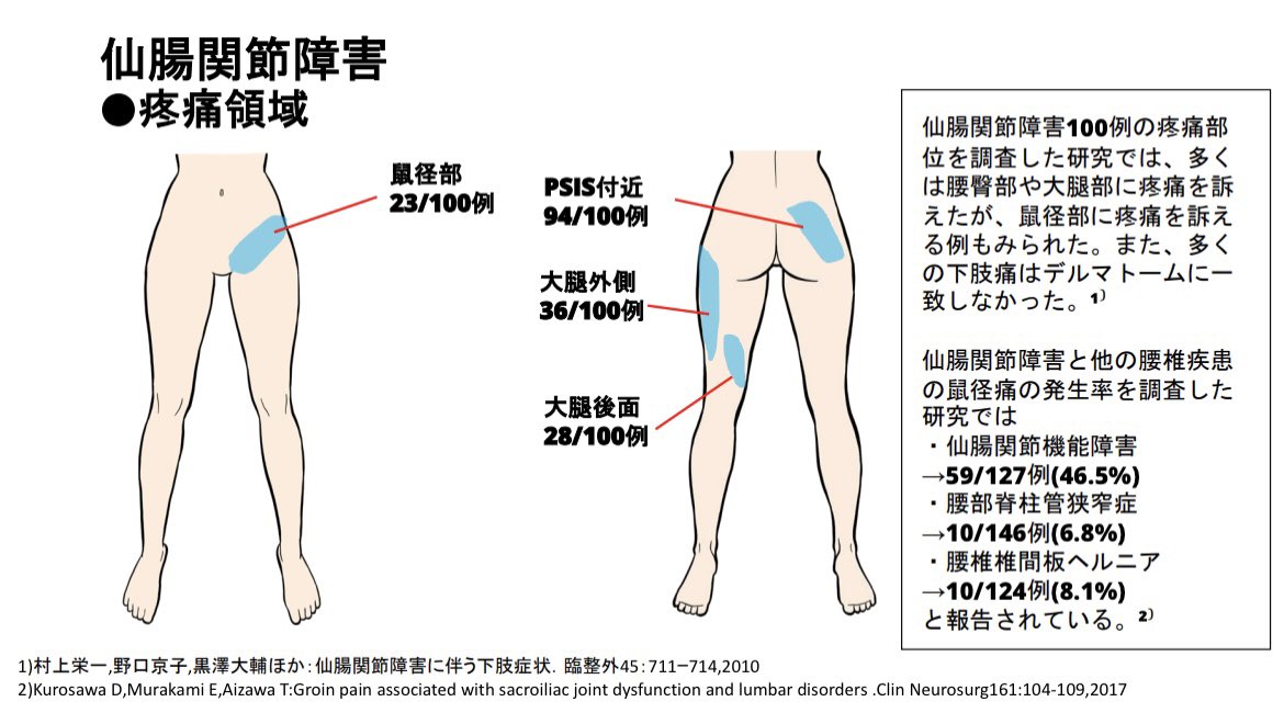 仙腸関節障害の疼痛領域
