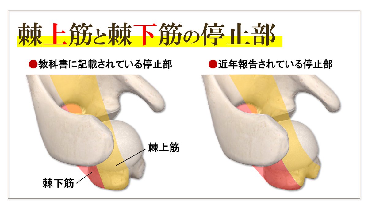棘上筋と棘下筋の停止部に関するまとめ