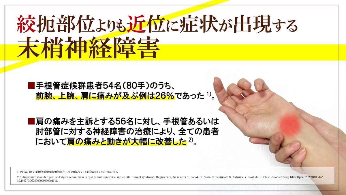 絞扼部位よりも近位に症状が出現する末梢神経障害