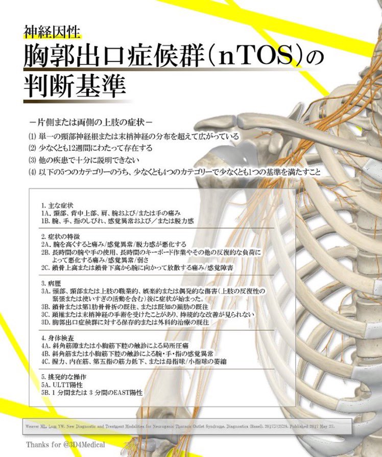 神経因性胸郭出口症候群の判断基準