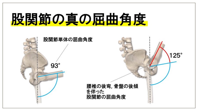 股関節屈曲可動域と骨盤・腰椎の動きに関する資料