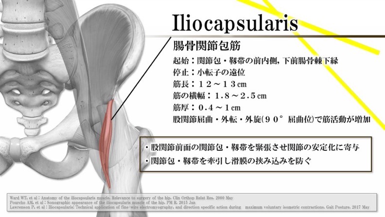 腸骨関節包筋の解剖と股関節痛評価に関する資料