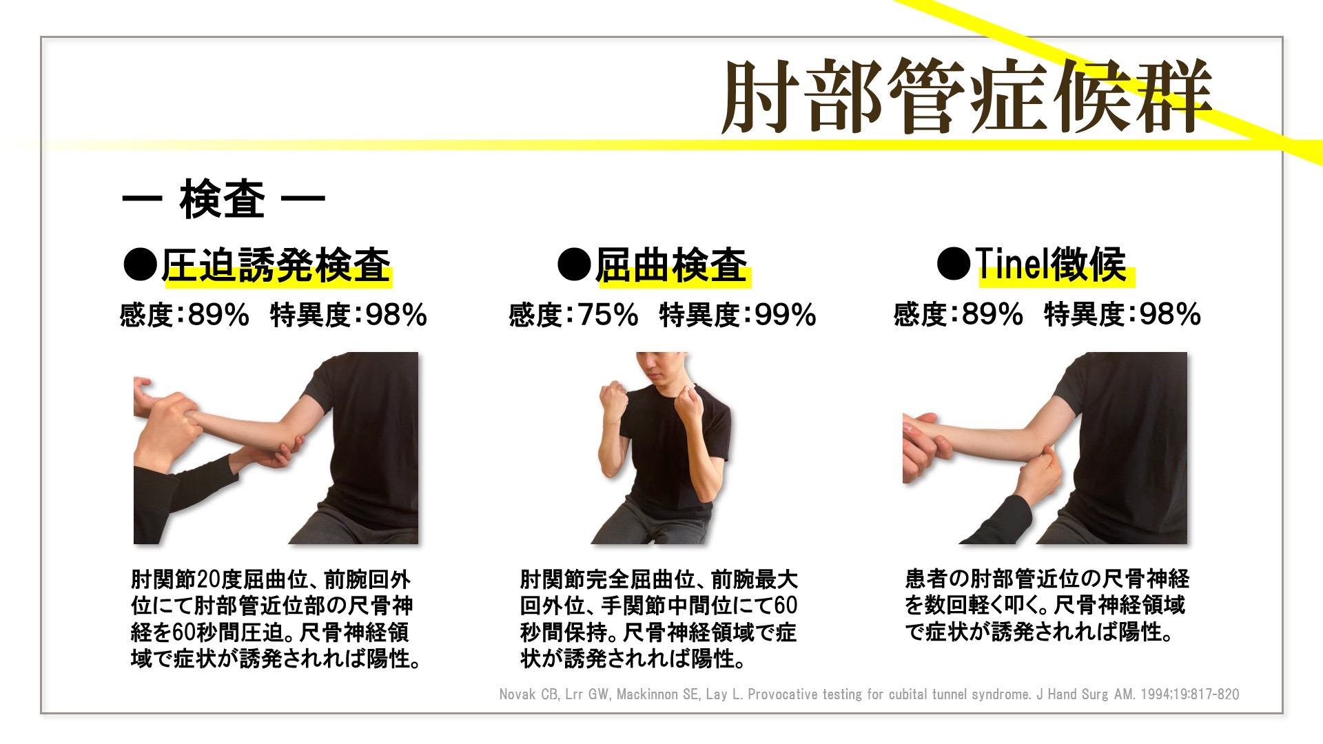肘部管症候群の評価を目的に合わせて整理する資料