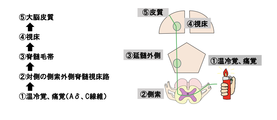 痛覚と温冷覚の伝導路