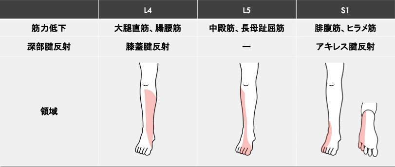 L4 L5 S1の感覚 筋力 反射の整理