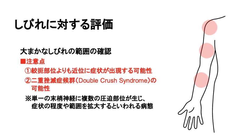 ダブルクラッシュ症候群で注意する複数圧迫の考え方