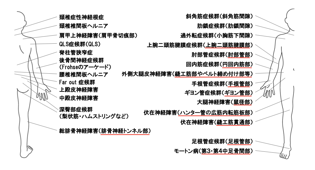 しびれで疑う神経障害部位の地図