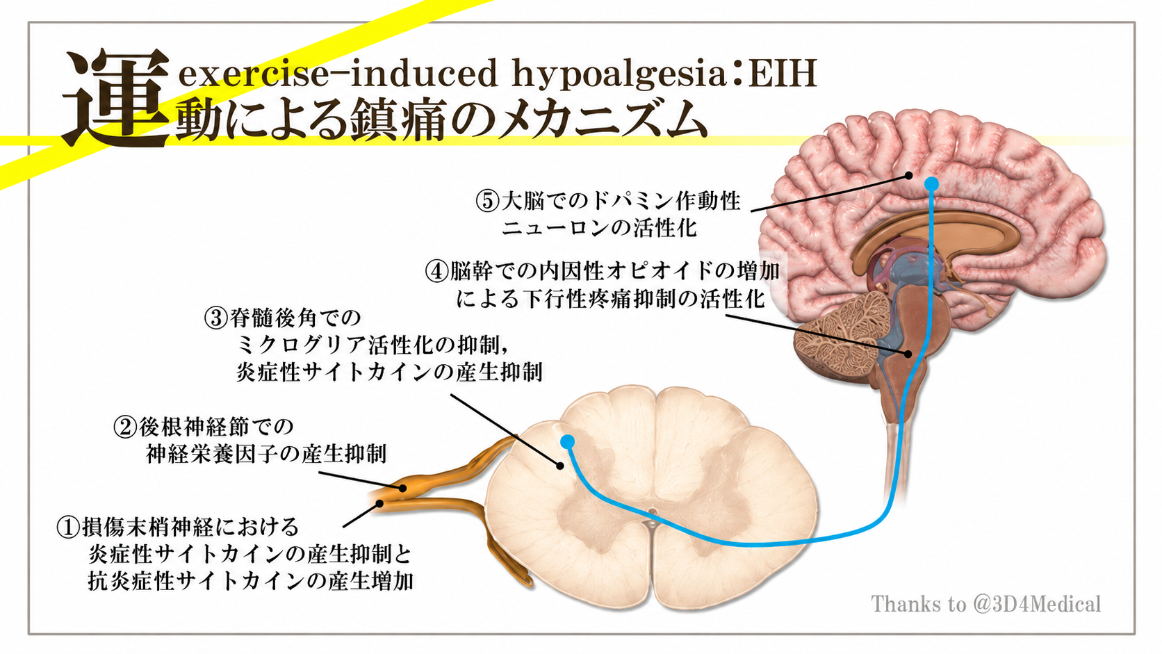 運動による鎮痛（EIH・運動誘発性鎮痛）のメカニズムを、損傷末梢神経・後根神経節・脊髄後角・脳幹・大脳の5段階で示した図解