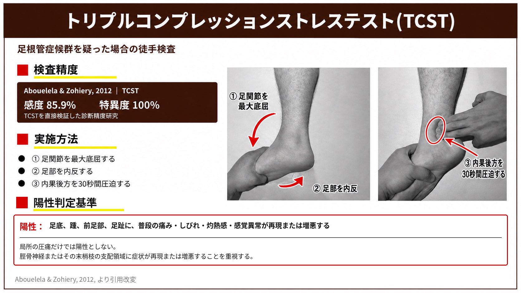 トリプルコンプレッションストレステスト（TCST）の手順と陽性基準の図解