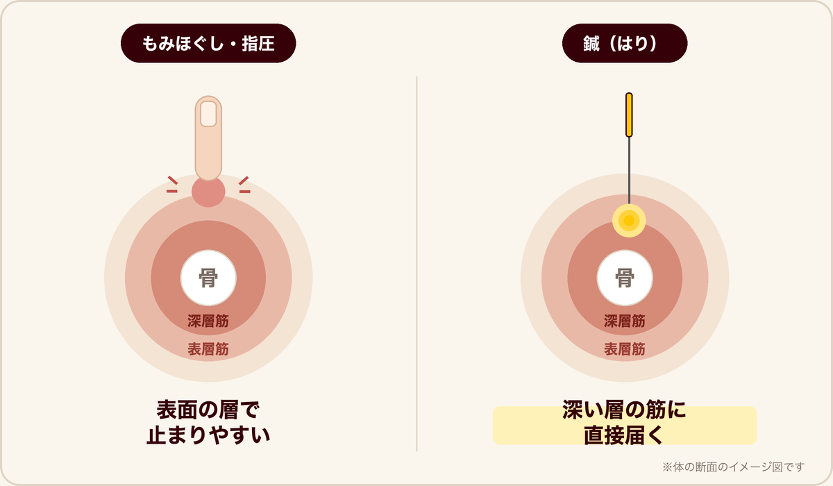 もみほぐしと鍼の届く深さの違い（体の断面のイメージ図）